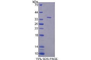 Image no. 1 for Receptor (TNFRSF)-Interacting serine-threonine Kinase 1 (RIPK1) (AA 17-289) protein (His tag) (ABIN6240001)