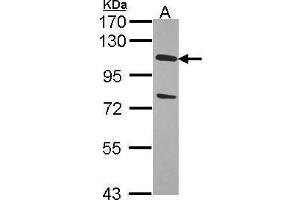 Image no. 1 for anti-Ubiquitin Specific Peptidase 28 (USP28) (C-Term) antibody (ABIN2855882)