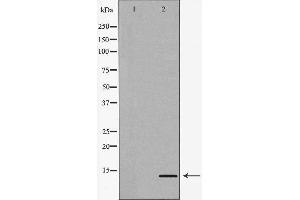 Image no. 1 for anti-Chemokine (C-C Motif) Ligand 24 (CCL24) (C-Term) antibody (ABIN6260542)