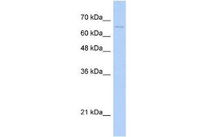 Image no. 1 for anti-Midline 1 (MID1) (N-Term) antibody (ABIN2787522)