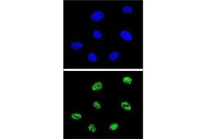 Image no. 4 for anti-Tumor Protein P73 (TP73) (AA 288-317) antibody (ABIN3029400)