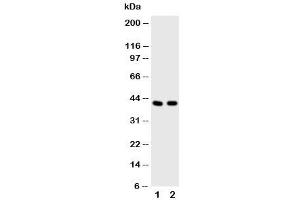 Image no. 3 for anti-Histone Deacetylase 8 (HDAC8) (N-Term) antibody (ABIN3031236)