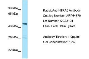 Image no. 1 for anti-HtrA Serine Peptidase 3 (HTRA3) (Middle Region) antibody (ABIN2789881)