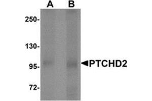 Western blot analysis of PTCHD2 in mouse kidney tissue lysate with PTCHD2 Antibody  at (A) 1 and (B) 2 μg/ml.