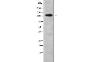 Image no. 2 for anti-ADAM Metallopeptidase with Thrombospondin Type 1 Motif, 1 (ADAMTS1) antibody (ABIN6259779)