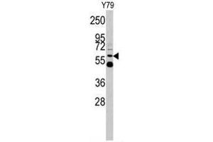 Image no. 1 for anti-UDP Glucuronosyltransferase 2 Family, Polypeptide B17 (UGT2B17) (Middle Region) antibody (ABIN453451)