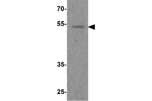 Image no. 1 for anti-Forkhead Box G1 (FOXG1) (Internal Region) antibody (ABIN6656522)