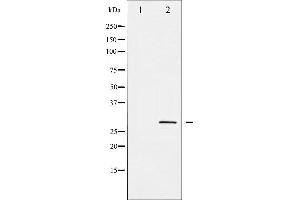 Image no. 1 for anti-SNAIL (SNAI1) (pSer246) antibody (ABIN6256209)
