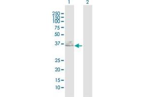 Anti Fut1 Antibody 1 365 Product No Abin