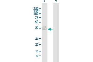 Anti Fut1 Antibody 1 365 Product No Abin