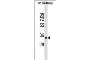ZFP36L2 Antibody (Center) (ABIN1537929 and ABIN2849247) western blot analysis in mouse kidney tissue lysates (35 μg/lane).