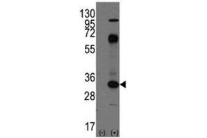 Image no. 5 for anti-CD8a Molecule (CD8A) (AA 150-180) antibody (ABIN3030431)