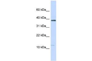 Image no. 1 for anti-serine Peptidase Inhibitor, Kazal Type 1 (SPINK1) (N-Term) antibody (ABIN2778165)