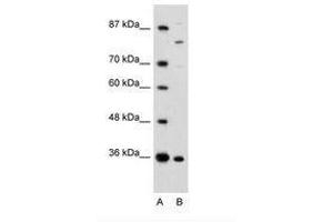 Image no. 1 for anti-Ankyrin Repeat and Zinc Finger Domain Containing 1 (ANKZF1) (AA 106-155) antibody (ABIN6735962)
