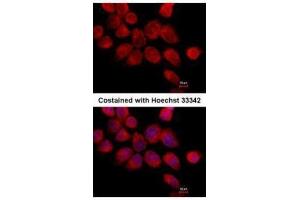 ICC/IF Image Immunofluorescence analysis of paraformaldehyde-fixed A431, using Transketolase, antibody at 1:500 dilution.