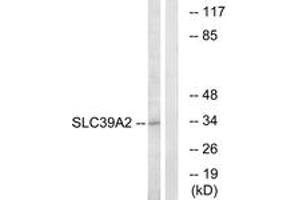 Image no. 1 for anti-Solute Carrier Family 39 (Zinc Transporter), Member 2 (Slc39a2) (AA 11-60) antibody (ABIN1535490)