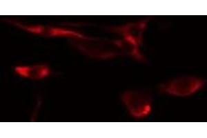 Image no. 2 for anti-Raftlin, Lipid Raft Linker 1 (RFTN1) (Internal Region) antibody (ABIN6259466)