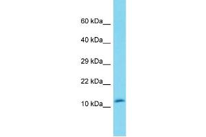 DEFB119 Antikörper  (N-Term)