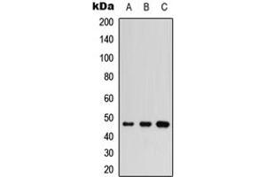Image no. 2 for anti-Inhibitor of kappa Light Polypeptide Gene Enhancer in B-Cells, Kinase gamma (IKBKG) (Center) antibody (ABIN2972911)