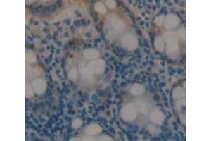 Image no. 1 for anti-Protein-L-Isoaspartate (D-Aspartate) O-Methyltransferase (PCMT1) (AA 2-227) antibody (ABIN1869702)