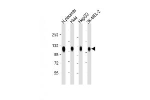 Image no. 3 for anti-Lysosomal-Associated Membrane Protein 2 (LAMP2) antibody (ABIN650660)