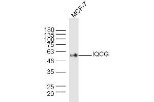 Image no. 1 for anti-IQ Motif Containing G (IQCG) antibody (ABIN1385332)