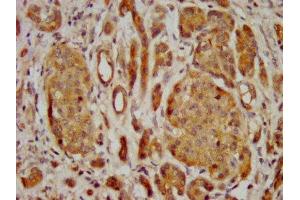 FREM2 antibody  (AA 1986-2127)