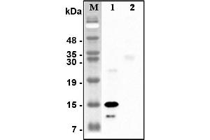 Image no. 2 for anti-C1q and Tumor Necrosis Factor Related Protein 5 (C1QTNF5) antibody (ABIN1169281)