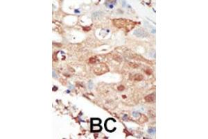 Image no. 2 for anti-Phosphoinositide 3 Kinase, p85 beta (PI3K p85b) (AA 268-298), (C-Term) antibody (ABIN392575)