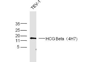 Image no. 1 for anti-HCG beta antibody (ABIN723111)