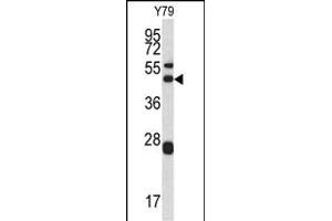 ARPC1A Antikörper  (AA 157-184)