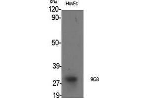 Image no. 2 for anti-Splicing Factor, Arginine/Serine Rich 7 (SFRS7) (Internal Region) antibody (ABIN3183100)