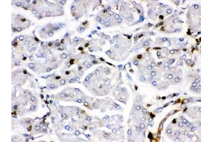 Image no. 3 for anti-FBJ Murine Osteosarcoma Viral Oncogene Homolog B (FOSB) (AA 264-291), (C-Term) antibody (ABIN3042399)
