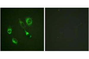 Immunofluorescence analysis of HeLa cells, using EPHA2/3 (Phospho-Tyr588/596) Antibody.