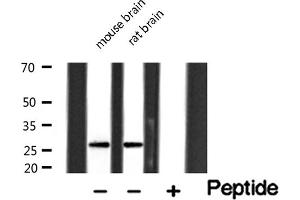Image no. 4 for anti-Granzyme B (GZMB) antibody (ABIN6262072)