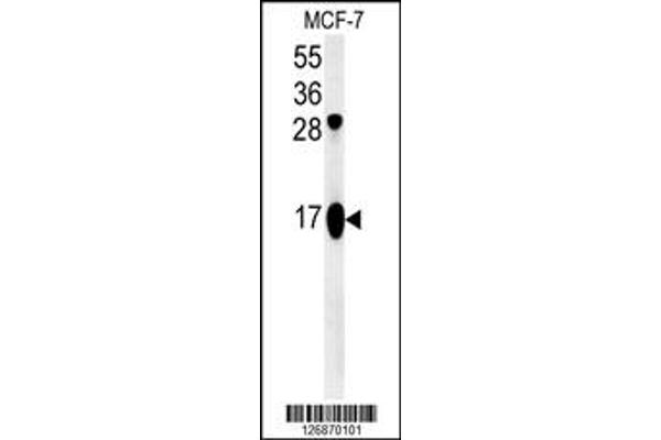 anti-ATP Synthase, H+ Transporting, Mitochondrial Fo Complex, Subunit J2 (ATP5J2) antibody