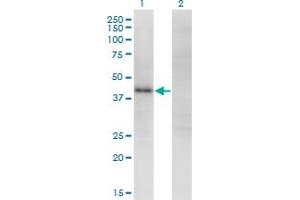 Western Blot analysis of ZSCAN16 expression in transfected 293T cell line by ZNF435 monoclonal antibody (M01), clone 4A9.