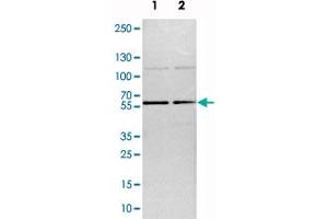 Image no. 4 for anti-TOX High Mobility Group Box Family Member 4 (TOX4) antibody (ABIN5589955)