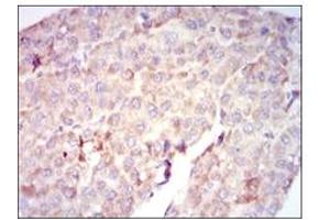 Image no. 2 for anti-V-Raf-1 Murine Leukemia Viral Oncogene Homolog 1 (RAF1) antibody (ABIN1108823)