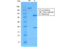 Image no. 7 for anti-beta-2-Microglobulin (B2M) antibody (ABIN6940416)