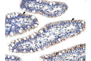 Image no. 2 for anti-Kelch-Like 13 (KLHL13) (N-Term) antibody (ABIN927501)