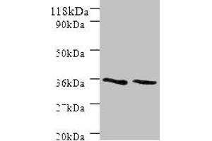 Sorting Nexin 2 Antikörper  (AA 1-102)