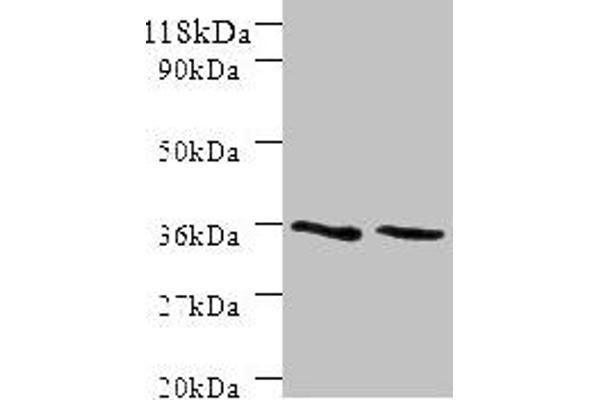 Sorting Nexin 2 anticorps  (AA 1-102)