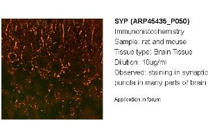 Image no. 2 for anti-Synaptophysin (SYP) (N-Term) antibody (ABIN2782216)