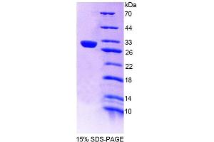 Image no. 1 for Protein tyrosine Phosphatase, Non-Receptor Type 14 (PTPN14) (AA 1-188) protein (T7 tag,His tag) (ABIN6239272)