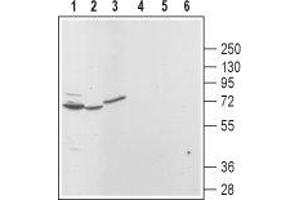 Mucolipin 3 antibody  (Cytoplasmic Domain, Intracellular)