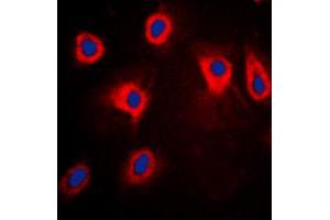 Image no. 1 for anti-Mitogen-Activated Protein Kinase Kinase Kinase 8 (MAP3K8) (pSer290) antibody (ABIN2707193)