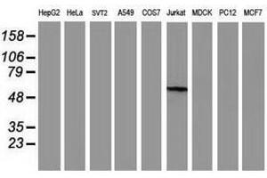 Image no. 18 for anti-Glucosidase, Beta, Acid 3 (Cytosolic) (GBA3) (AA 1-150), (AA 370-469) antibody (ABIN1490582)