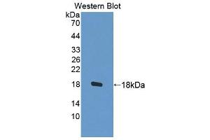 Image no. 2 for anti-Tubulin Folding Cofactor A (TBCA) (AA 2-108) antibody (ABIN5014467)