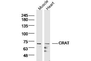 Image no. 1 for anti-Carnitine O-Acetyltransferase (CRAT) (AA 301-400) antibody (ABIN1713971)